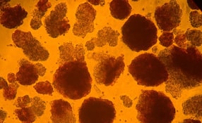 pankrease saarerakud mikroskoobi all